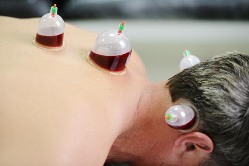Best Cupping Therapy for Men in Mumbai